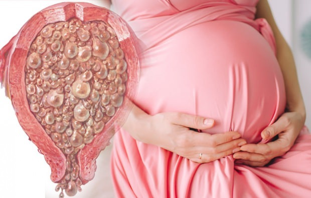 Co je hroznové těhotenství, hroznové těhotenské příznaky