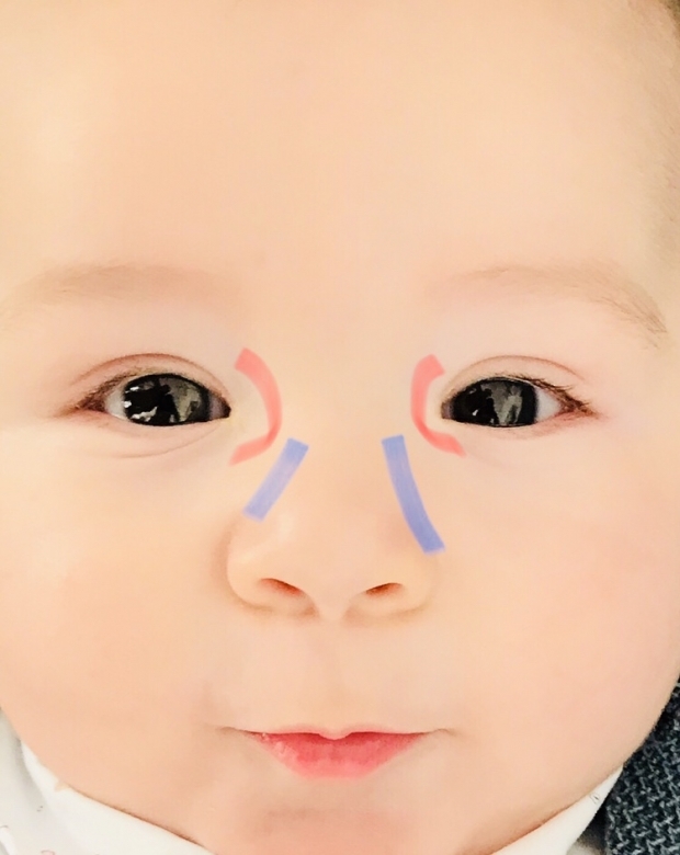 Masáž očních otřepů u kojenců
