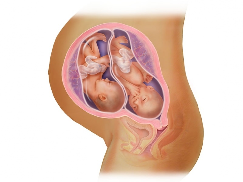 Dvojčata v IVF! Co je to přenos embryí?
