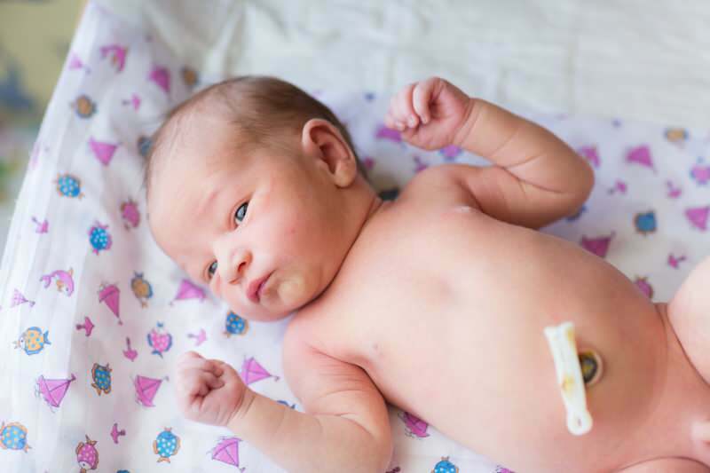 Pozdní řez pupeční šňůry u kojenců