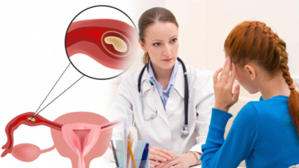 Co je mimoděložní těhotenství (mimoděložní těhotenství), proč? Jaké jsou příznaky mimoděložního těhotenství?
