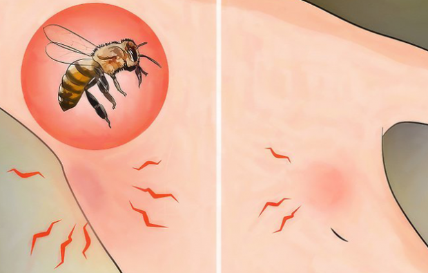 Co je to alergie na včely a jaké jsou příznaky? Přírodní metody, které jsou dobré pro bodnutí včel