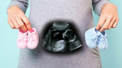 Bude se pohlaví dítěte určovat v prvním trimestru těhotenství?