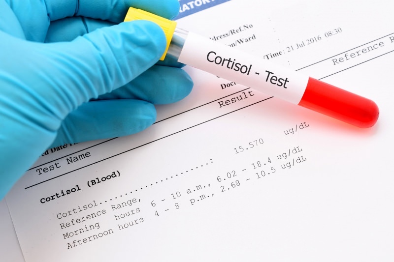 hladina kortizolu se objevuje při krevních testech