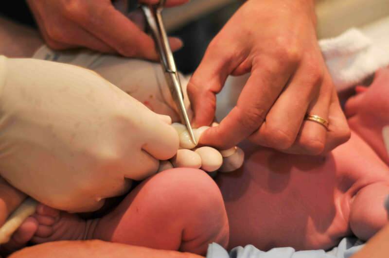 Kdy by měla být pupeční šňůra nakrájena na kojence?
