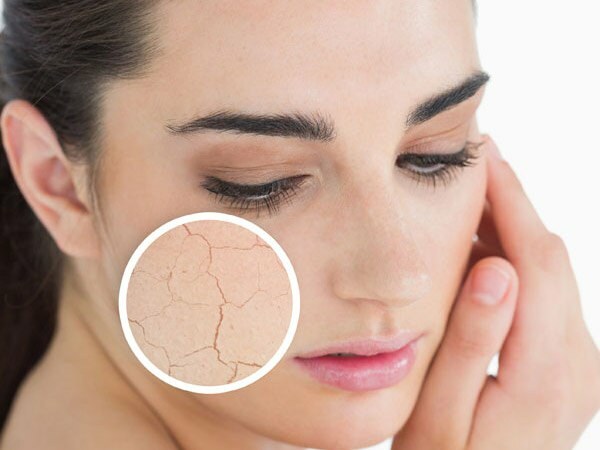 Tipy pro péči o suchou pokožku