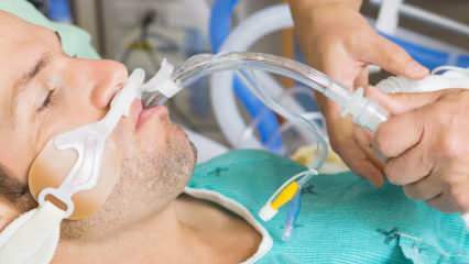 Jaká je intubace, kterou řekl Fahrettin Koca? Co to znamená intubovat pacienta? Uzdraví se intubovaný pacient?