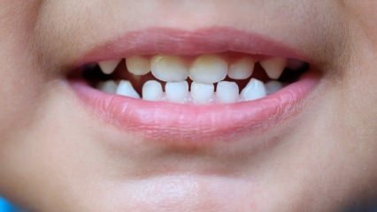 Jak učit děti zubní péči?