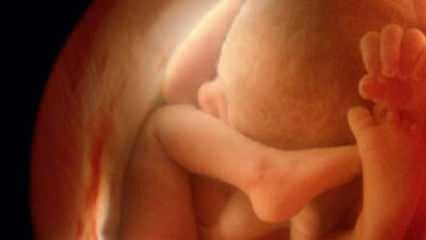 Nezobrazování pohlaví dítěte na ultrazvuku! Jak vypadají malí chlapci a děvčata na ultrazvuku?