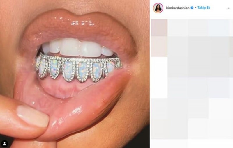 Zubní klenot Kim Kardashian v hodnotě 5 000 $