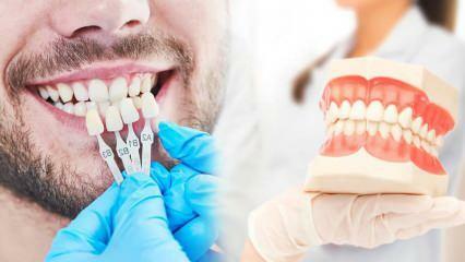 Proč se na zuby aplikuje zirkoniová fazeta? Jak odolný je zirkonový povlak?