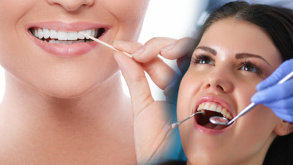 Jak si udržet zdraví úst a zubů? Na co je třeba myslet při čištění zubů?