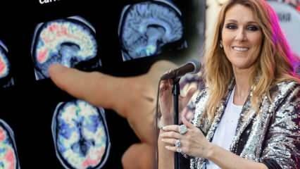 Co je syndrom ztuhlého člověka? Celine Dion