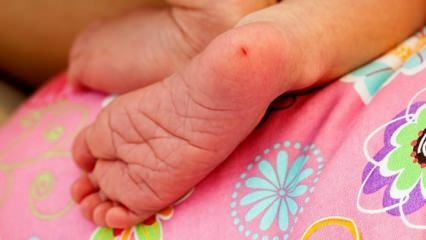 Proč je krev u paty odebírána kojencům? Požadavky na vyšetření pupkové krve u kojenců