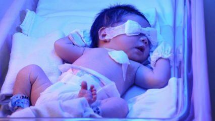Co je novorozená žloutenka? Jak prochází žloutenka u dětí doma? Stupeň žloutenky u kojenců