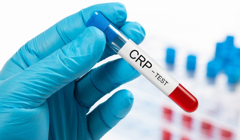 Proč CRP v krvi stoupá? Co je CRP? Jak snížit CRP?
