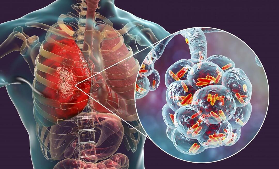 Co je zápal plic a jaké jsou jeho příznaky? Jak se léčí nový epidemický virus pneumonie?