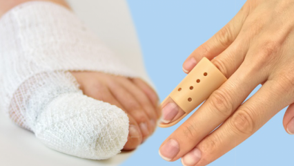 Co způsobuje zlomení prstu? Jaké jsou příznaky zlomení prstu?