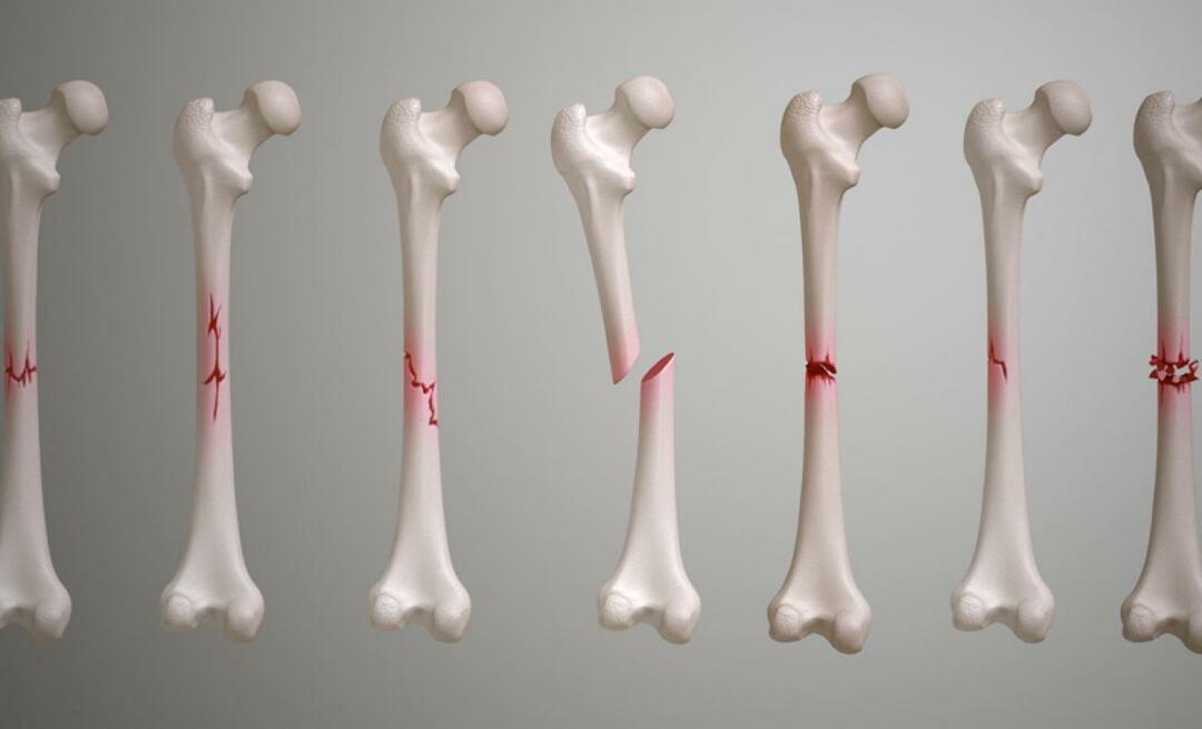 Co je klíční kost? Jak dlouho trvá, než se zlomenina klíční kosti zahojí?