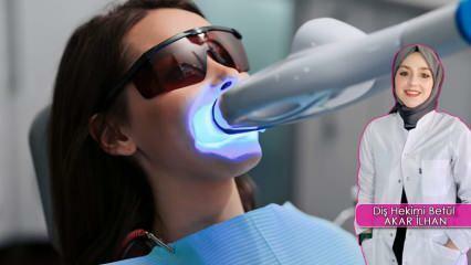 Jak probíhá metoda bělení zubů (Bleaching)? Poškozuje metoda bělení zuby?