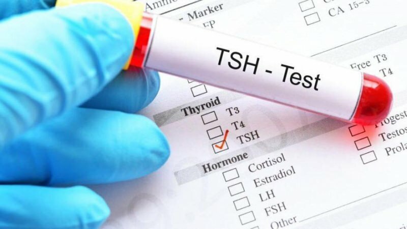 tsh test je hormonální test