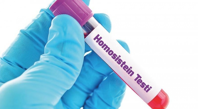 Zvýšení obsahu homocysteinové látky 