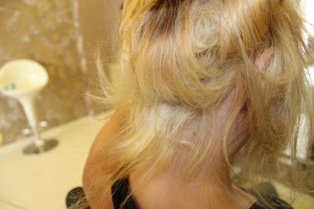 Co se dělá s hořícími vlasy ze středu? Jak by měly být ošetřené vlasy udržovány?