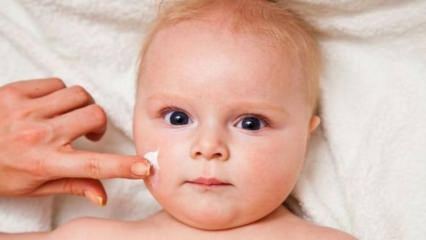Tipy pro péči o pleť pro kojence! Jaké jsou kožní problémy u kojenců?