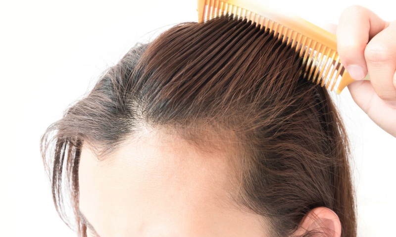 řešení pro vypadávání vlasů po porodu! Co je dobré pro vypadávání vlasů?