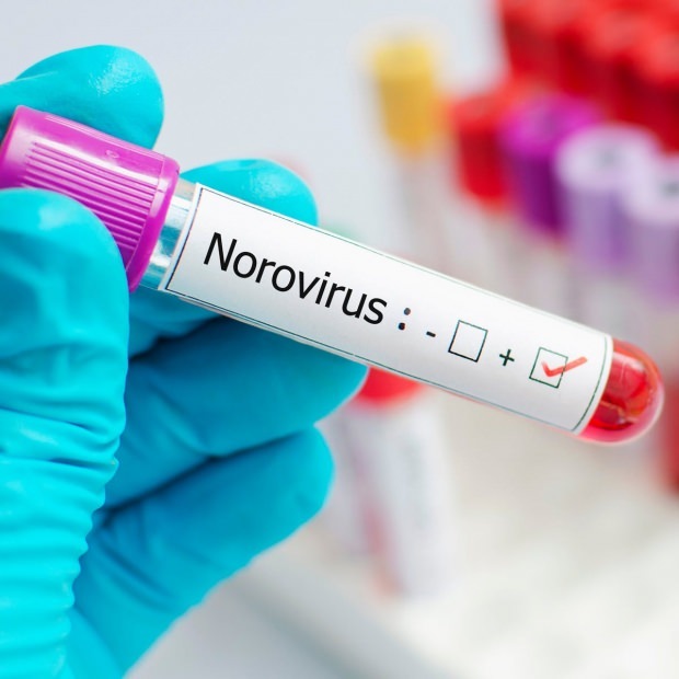 Co je norovirus a jaké choroby způsobují