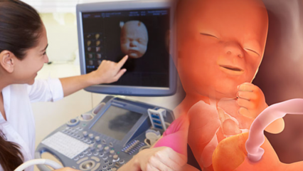 Který orgán se u kojenců vyvíjí jako první? Vývoj dítěte každý týden