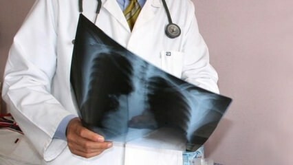 Odborníci oznámili! Zvýšení úmrtí na rakovinu plic