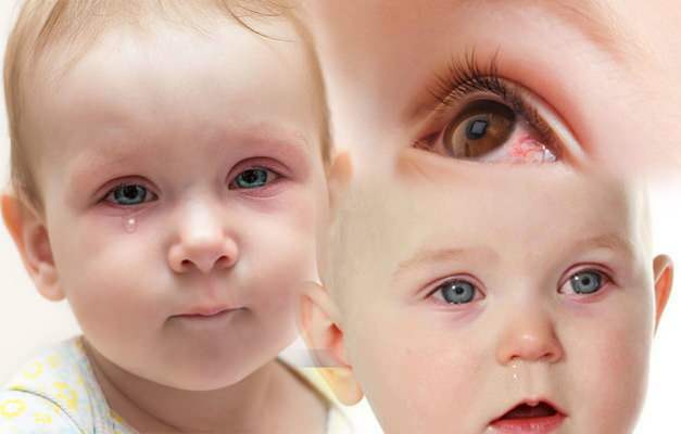 Proč oči dětí krví? Jak probíhá krvácení z oka u novorozence?
