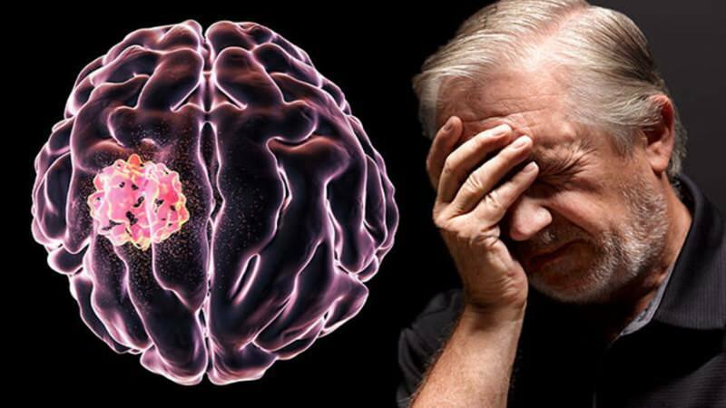 Tkáň vytvořená v mozku narušením buněčných struktur se nazývá nádor.