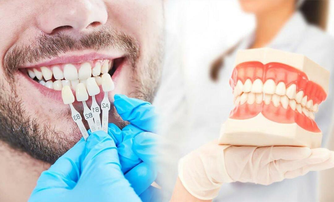 Proč se na zuby aplikují zirkonové korunky? Jak odolný je zirkonový povlak?