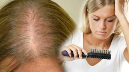 Jaká je nejúčinnější metoda proti vypadávání vlasů? Maskovat recepty, které zastavují vypadávání vlasů