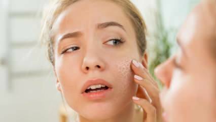 Proč je pokožka suchá? Co dělat na suché kůži? Nejúčinnější doporučení pro péči o suchou pokožku