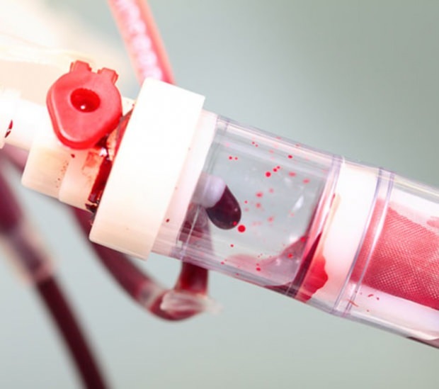 Co je nízká krevní destička (PLT)? Jaké jsou příznaky nedostatku krevních destiček?