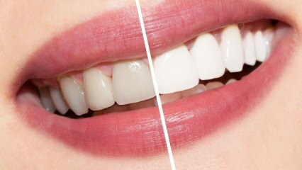 Jaká jsou doporučení pro bílé zuby? Bělení zubů přirozeně doma ...