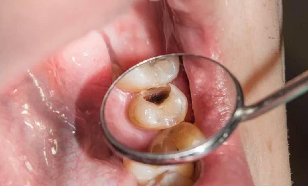 Proč zuby hnijí a co můžeme dělat, abychom tomu zabránili? 