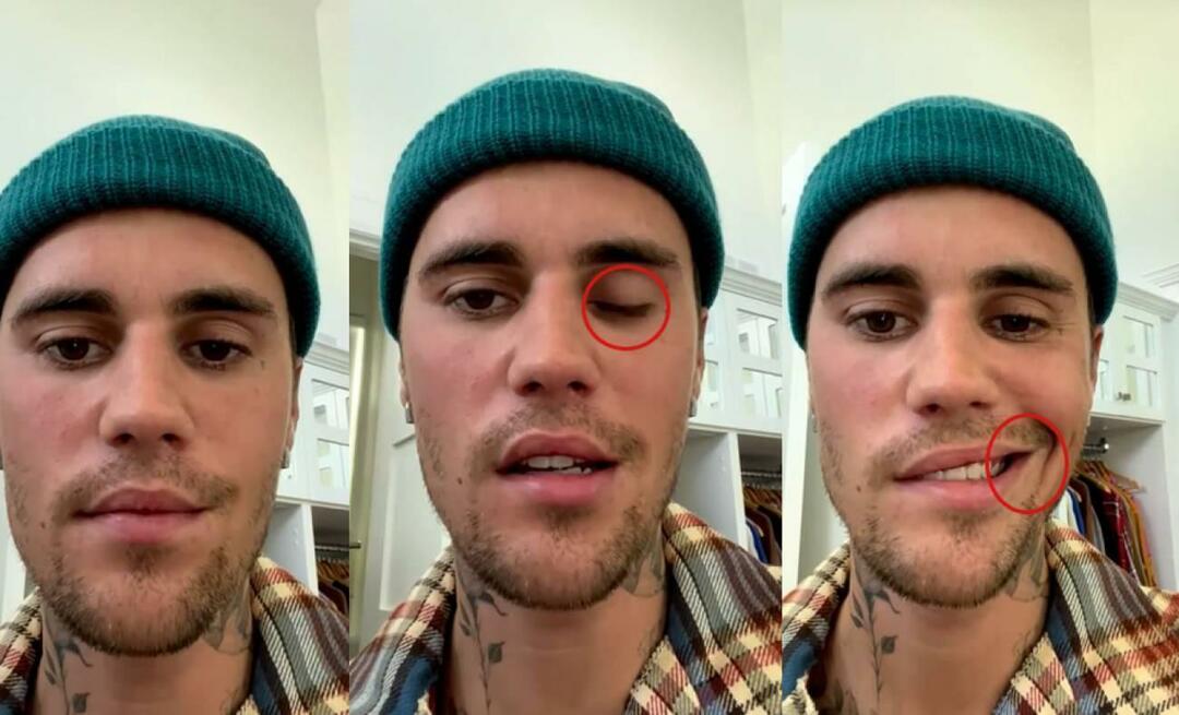 Justin Bieber měl paralýzu obličeje! Slavná hvězda nemůže znovu vyrazit na světové turné
