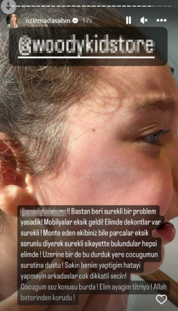 Dveře skříně spadly na tvář dcery Berkaye Şahina