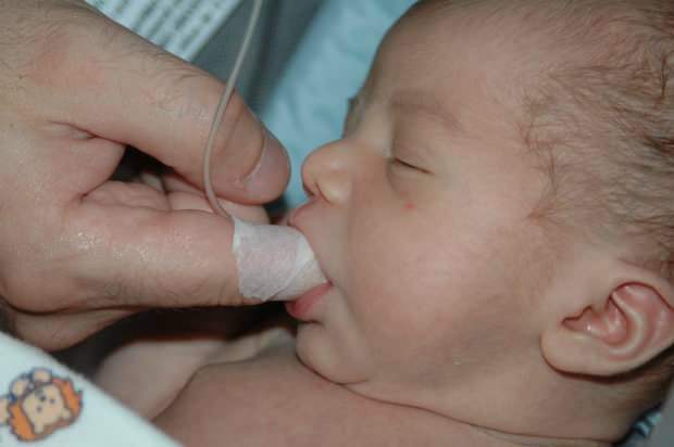 Co je metoda krmení prstem? Jak nakrmit dítě injekční stříkačkou?