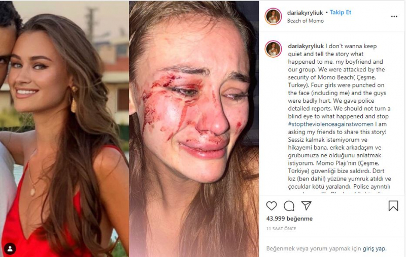 Ukrajinský top model Daria Kyryliuk, který byl údajně zbit v İzmir Çeşme, promluvil poprvé!