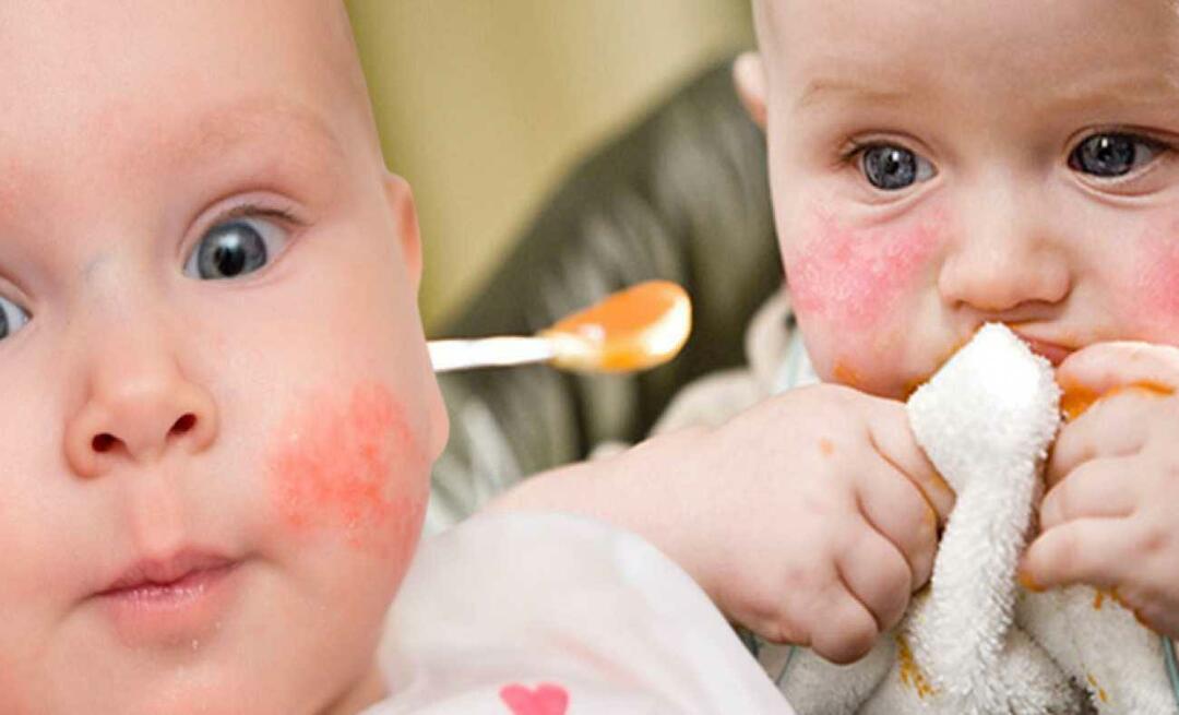 Co by mělo jíst dítě s alergií? Jaké jsou alternativní potraviny pro alergická miminka?
