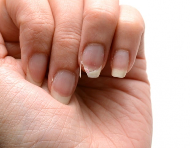 Jak se provádí péče o nehty? Rychlé metody prodlužování nehtů