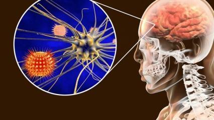 Co je meningitida a jaké jsou její příznaky? Existuje léčba meningitidy?