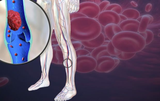 snížený krevní oběh v žilách nohou způsobuje bolest